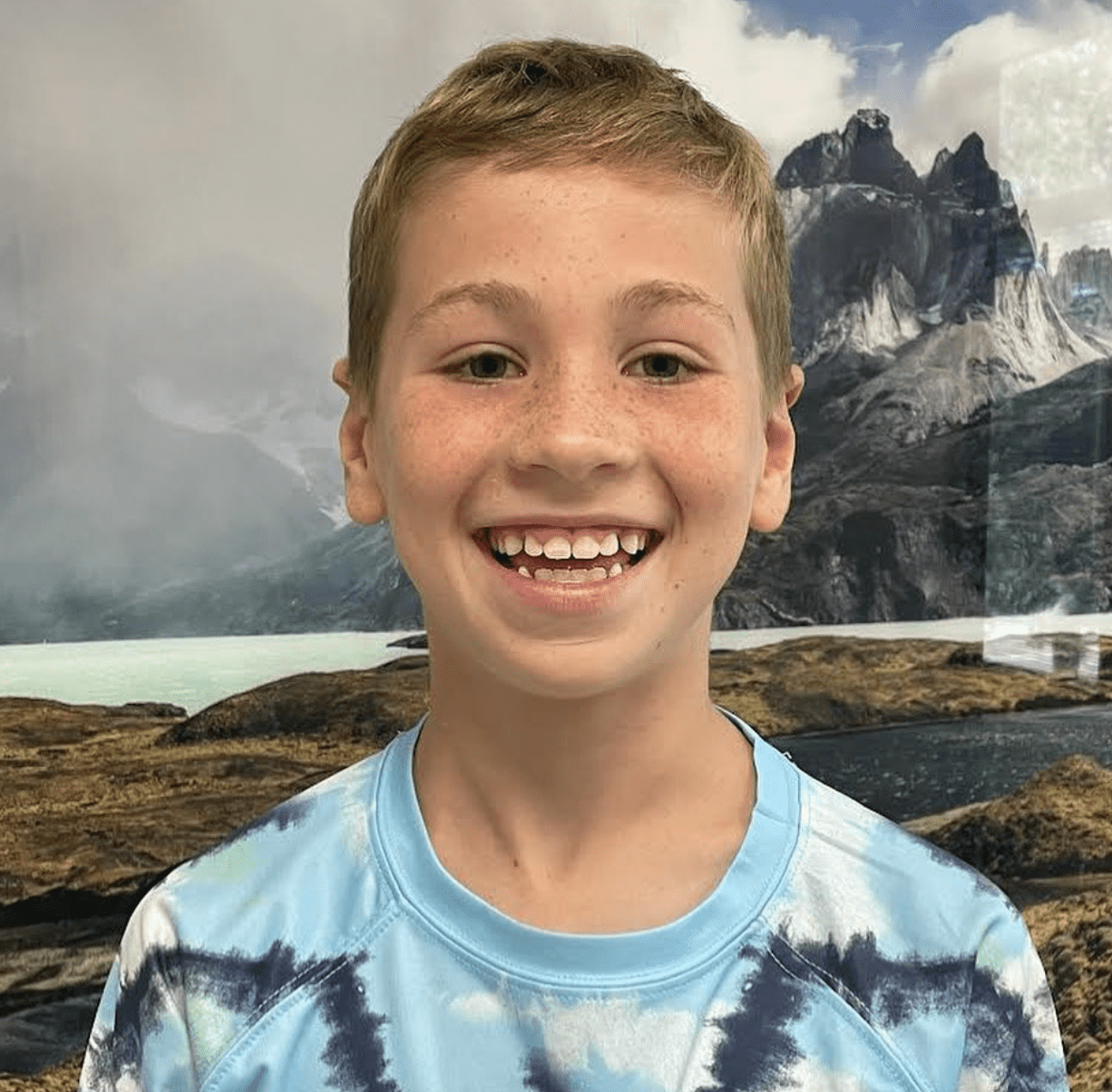 What To Expect When You Get Your Braces Off